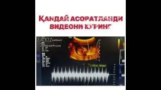 МАЛУМОТ УЧУН ФАКАТ ТЕЛЕГРАМДАН ЁЗИНГ: +998950014004 #Узи #беременность #гинекология #Хомиладорлик