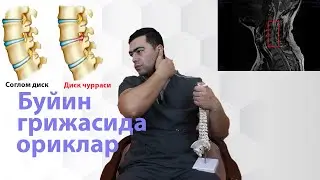Буйин ва кукрак диск чуррасидаги ориклар , куракдаги ориклар , уларни даволаш муолажалари