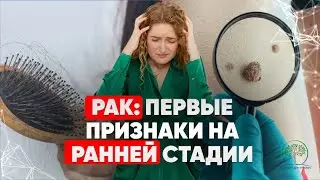 5 признаков онкологии ранней стадии. ТРЕВОЖНЫЕ ЗВОНОЧКИ, что делать?