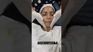I tried a Yellow Peel/Chemical Peel for my skin 