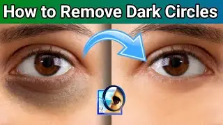 Photoshop ki madat se eye me dark circle kaise hataye | How to Remove dark circle in Photoshop