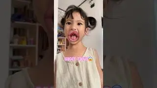 KAGET DARLEEN DI GIGIT 10 TIKUS KATANYA😱!! 