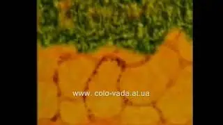 Что любит и чего боится раковая клетка