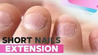 Short Nails Extension | Bitten Nails Transformation | Simple Glitter Nail Art