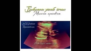 МАЛУМОТ УЧУН ФАКАТ ТЕЛЕГРАМДАН ЁЗИНГ: +998950014004 #Узи #беременность #гинекология #Хомиладорлик