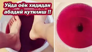 УЙ МУХИТИДА ОЁКЛАРНИНГ ХИДИ ТЕРЛАШИНИ АБАДИЙ ЙУКОТИШ УЧУН АРЗОН ТИЙИНЛИК ВОСИТА