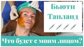 Поставил нити в лицо😱