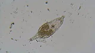 Pond Water Observation 20.04.2024 - Microscopic Claustrophobia