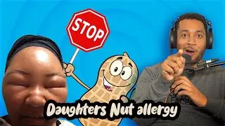 Jealous Dad makes fun of daughters nut allergy | Luke and Pete Talking Sheet Podcast