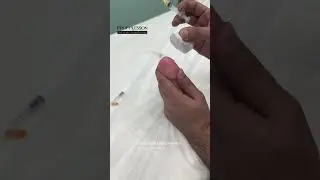 Увеличение полового члена