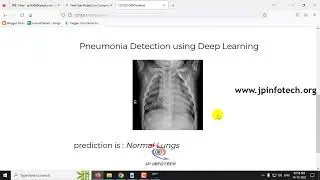 Pneumonia Detection using Deep Learning | Python Final Year IEEE Project 2023