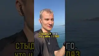 Я потерял глаз в 9 лет и в детстве думал, что я не красивый и у меня не будет девушки, а оказалось…