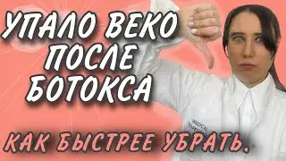 УПАЛО ОПУСТИЛОСЬ ВЕКО ПОСЛЕ БОТОКСА/УПАЛИ БРОВИ/ИСТИННЫЙ ПТОЗ/ОСЛОЖНЕНИЯ БОТОКС.