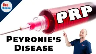 Why Platelet Therapy? Benefits and Risks | UroChannel