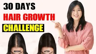 30 Days Challenge: How to Transform Thin Hair to Thick Hair Naturally