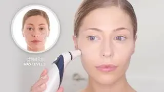 Аппарат для микродермабразии Homedics Radience (MDA-100-EU)