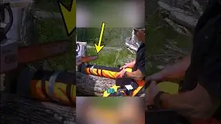 What if you cut your leg