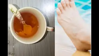 Сводит ноги судорогой что делать.