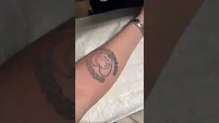 Фраме Тамер удаляет татуировку 