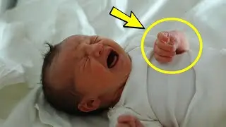 The doctors were at a loss when they saw the child! This happens once in a lifetime!