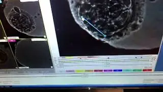 time-lapse observations-in vitro fertilization