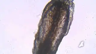 Human Hair Under Microscope