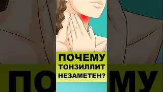 ПОЧЕМУ БОЛЬНОЙ НЕ ЗАМЕЧАЕТ ХРОНИЧЕСКИЙ ТОНЗИЛЛИТ?