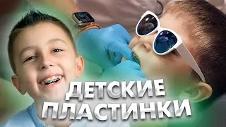 Установка детских ортодонтических пластинок