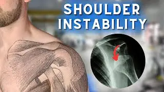 The BEST Exercises For Shoulder Instability!