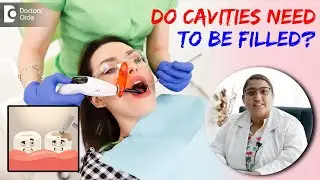 Do I really need to get a Cavity Filled?| Cavity Filling -Dr.Karthika Krishna Kumar| Doctors Circle