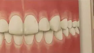 How To Have Pink Gums