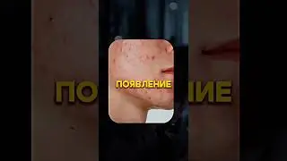Как стресс влияет на внешку #мужскойстиль #стиль #одежда #внешность