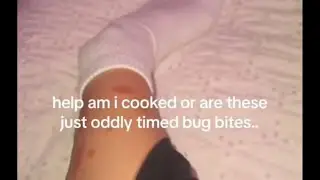This Is What Her Leg Looks Like Now 😰