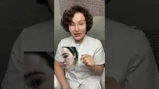 Что бывает, если неправильно подобран #пилинг