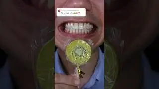 🥝 Satisfying ASMR Candy or Pen⁉️ 