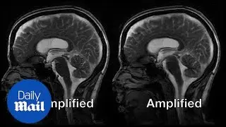 New MRI captures and magnifies the movement of the brain