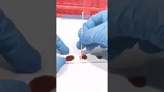 Blood typing procedure #mls #cls #medtechstudent #blood #laboratory