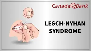 Lesch Nyhan Syndrome