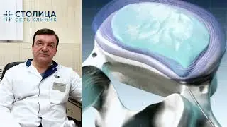 Холодноплазменная нуклеопластика – инновационная процедура для лечения протрузий и грыж