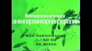 Гибель паразитов при действии Биорезонансной Терапии