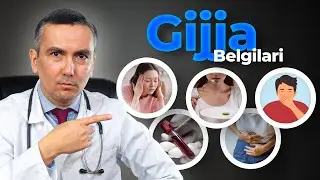 Gijjani aniqlash uchun 8 belgi!