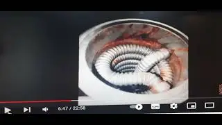 Сколько можно терпеть этого подонкиа Че Гевару?!!! Опять снял видео про колонну Селиваненко!!!