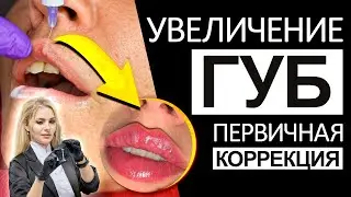 УВЕЛИЧЕНИЕ ГУБ / Первичная коррекция