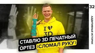 Ломаю руку и ставлю 3D печатный ортез | Аддитивное лечение