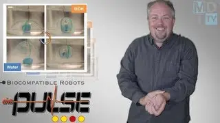 The Pulse: MRI-Safe Stimulator Implanted