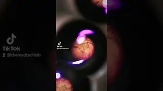 Surgical mask under the microscope (I didn't expect this) 