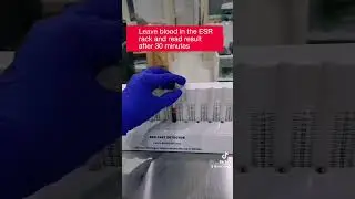 Erythrocyte sedimentation rate (ESR) is a blood test 