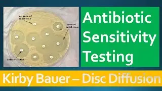 Kirby Bauer - Disc Diffusion Method for Antibiotic Susceptibility Testing
