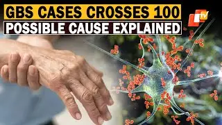 Guillain-Barre Syndrome Outbreak In Pune: DG ICMR Explains Possible Cause As Cases Exceed 100