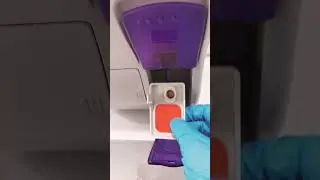 Running CBC Complete Blood Count